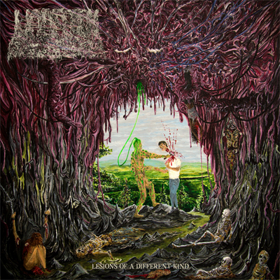 Undeath - Lesions Of A Different Kind